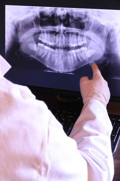 Best Emergency Dental Care for Broken or Chipped Teeth in Perryville, MD
